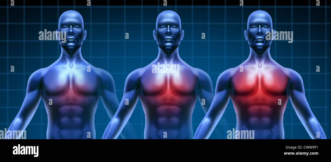 Heart illness getting gradualy worse represented by three humans with