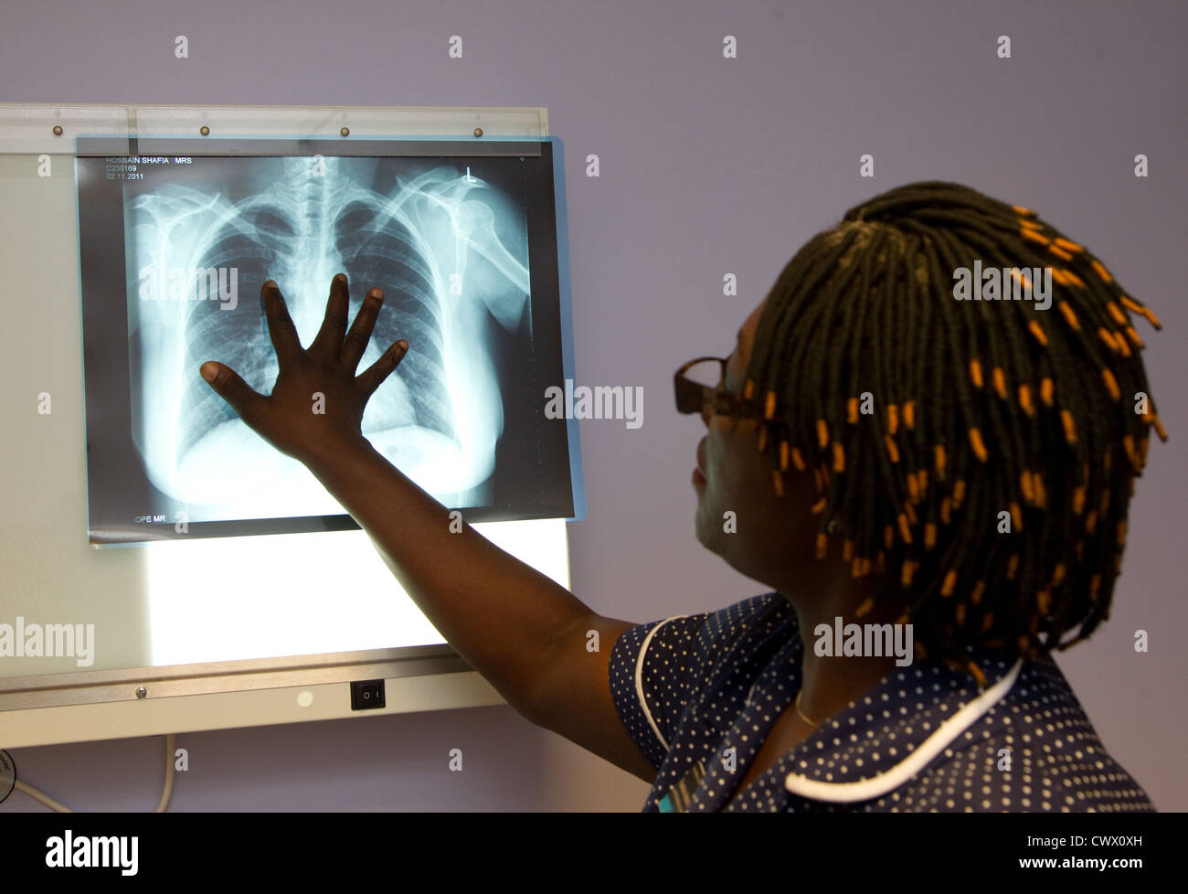 Sister looking at a chest Xray Stock Photo