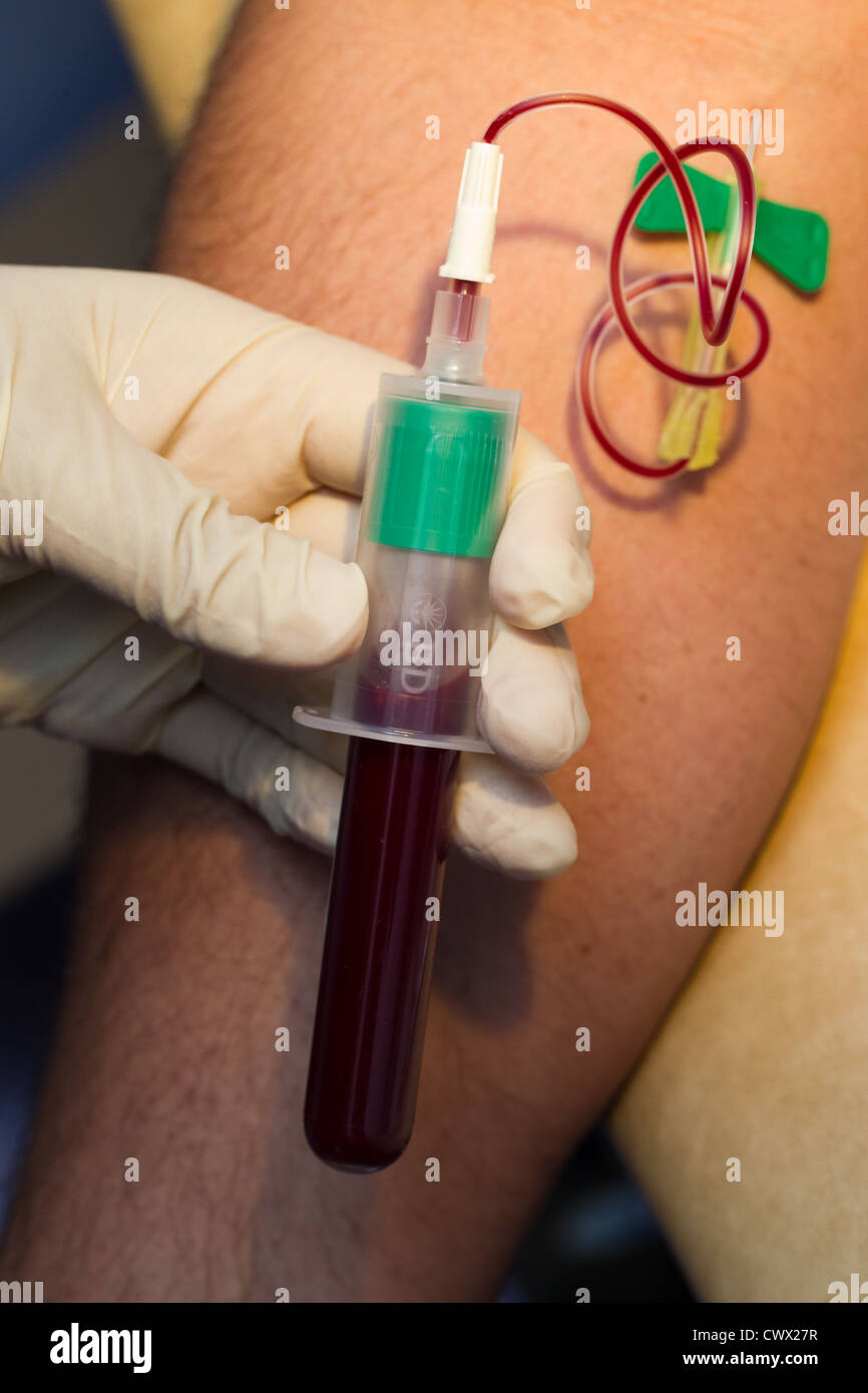 Blood test for Tuberculosis Stock Photo Alamy