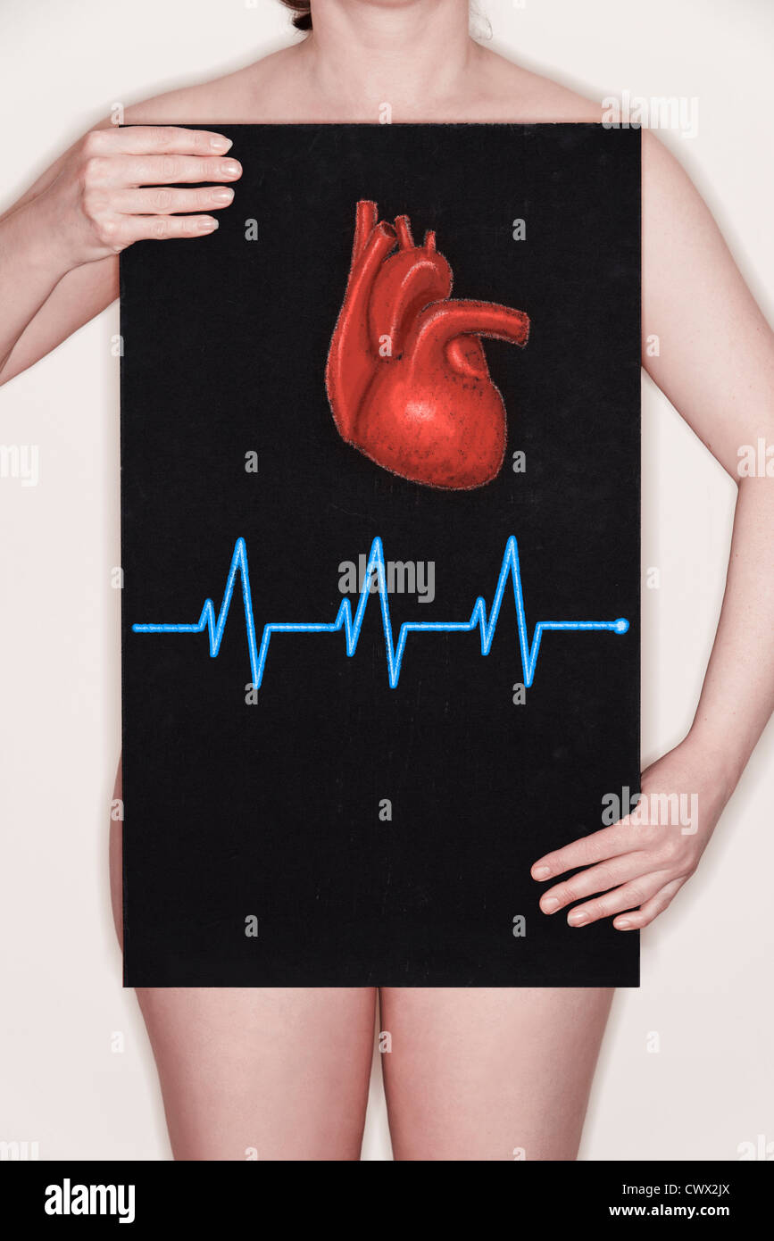 Woman holding a blackboard with an illustration of a human heart and an ECG pulse drawn on it in chalk. Concept image Stock Photo