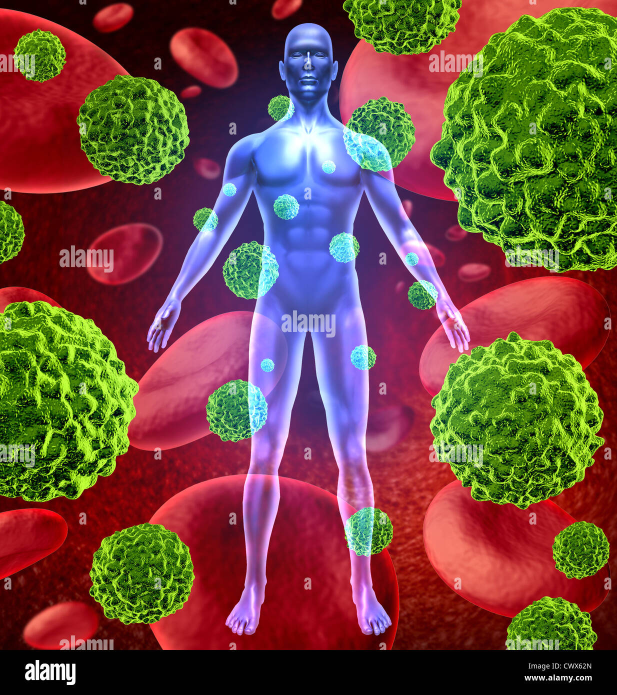 Human body with cancer cells spreading and growing through the body via red blood as malignant cells due to environmental carcinogens and genetic tumors and cell damage. Stock Photo