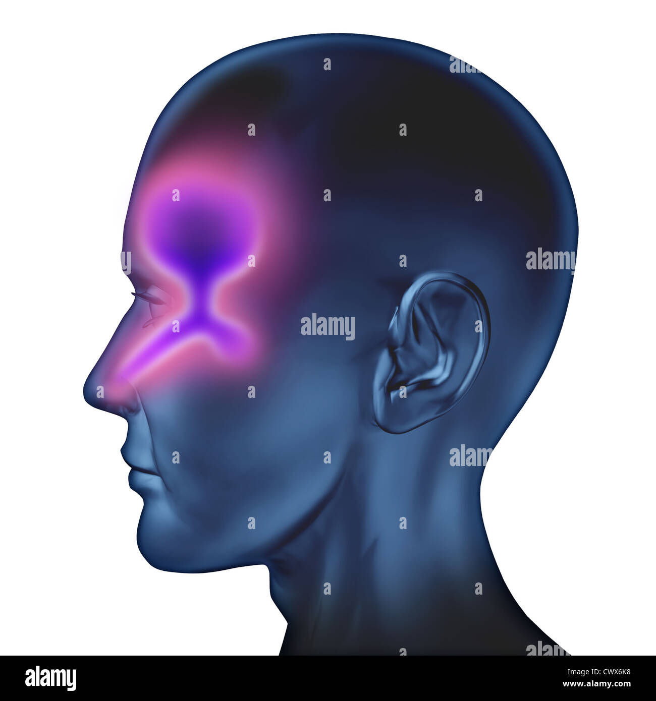 Human nasal congestion related to cold and bronchial flu coughing and