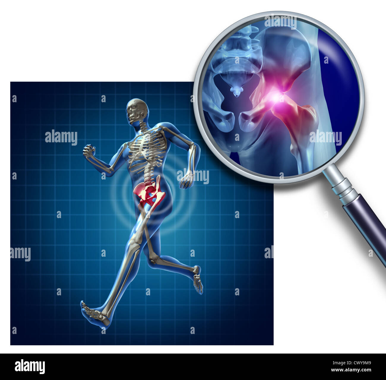 Sports Hip injury with a running athlete showing the anatomical