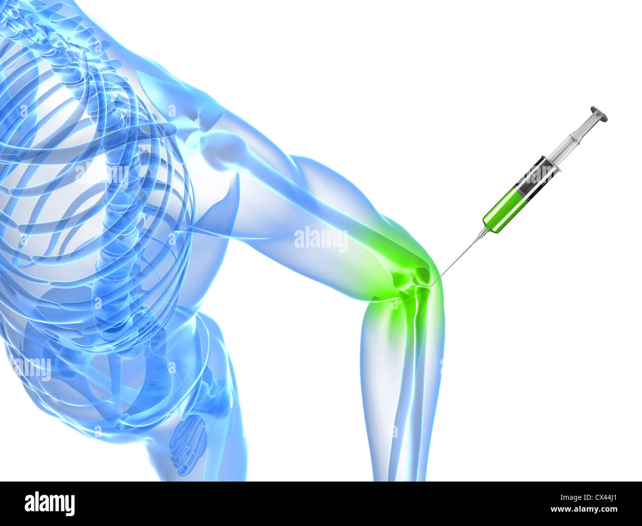 3d rendered illustration showing an elbow joint injection Stock Photo