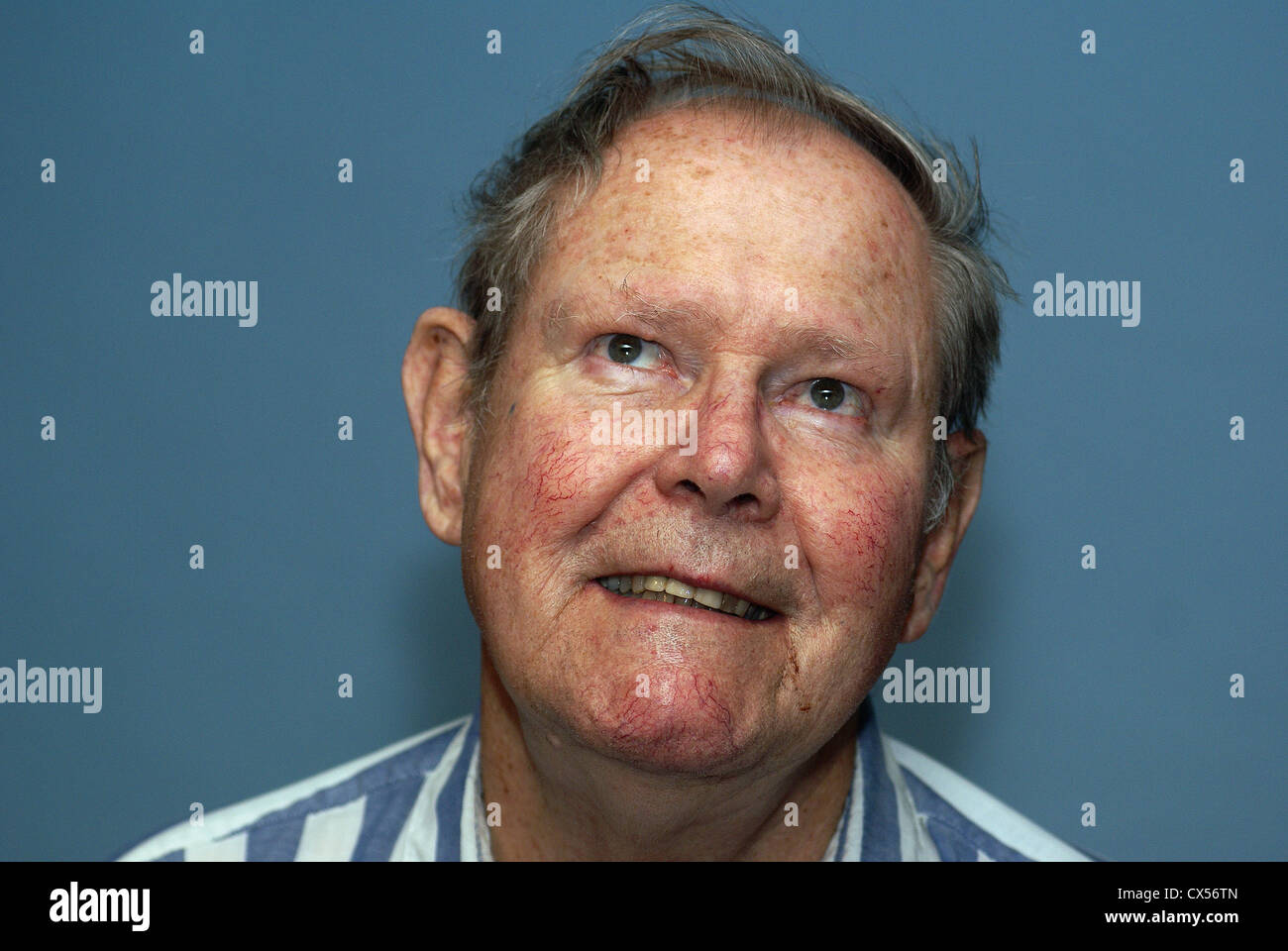 Elderly man's face showing age spots, blood vessels and skin sploctches. Stock Photo