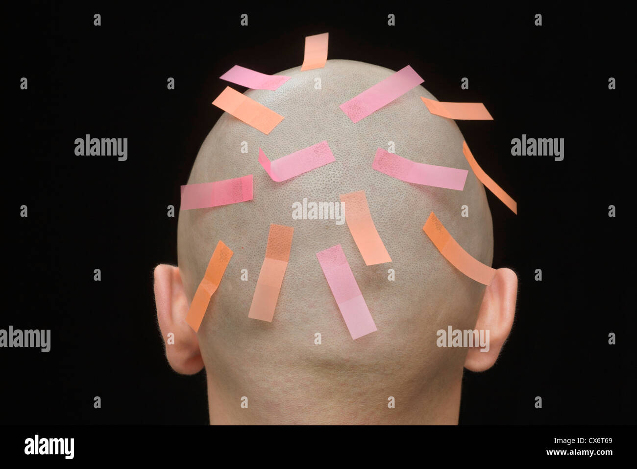 Adhesive tabs on the head of a man, rear view Stock Photo