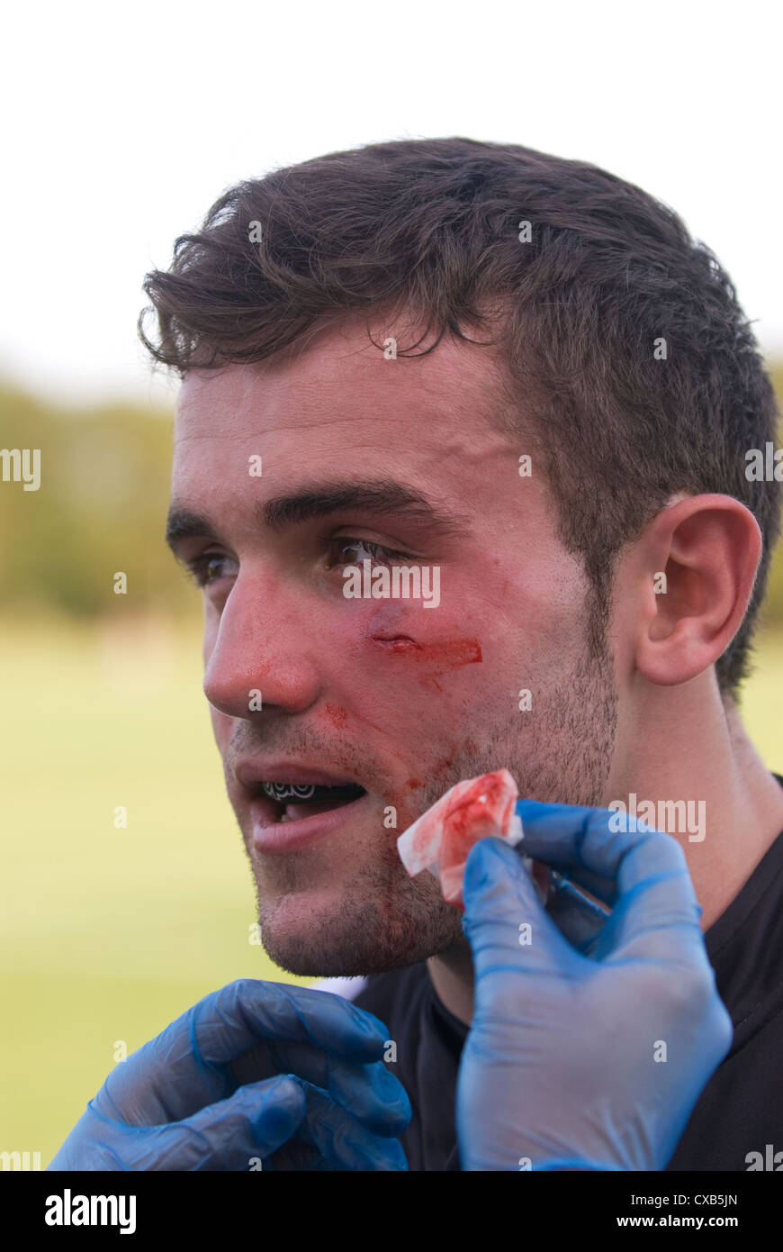 Rugby player receiving medical attention during game, Farnham, Surrey, UK. Stock Photo