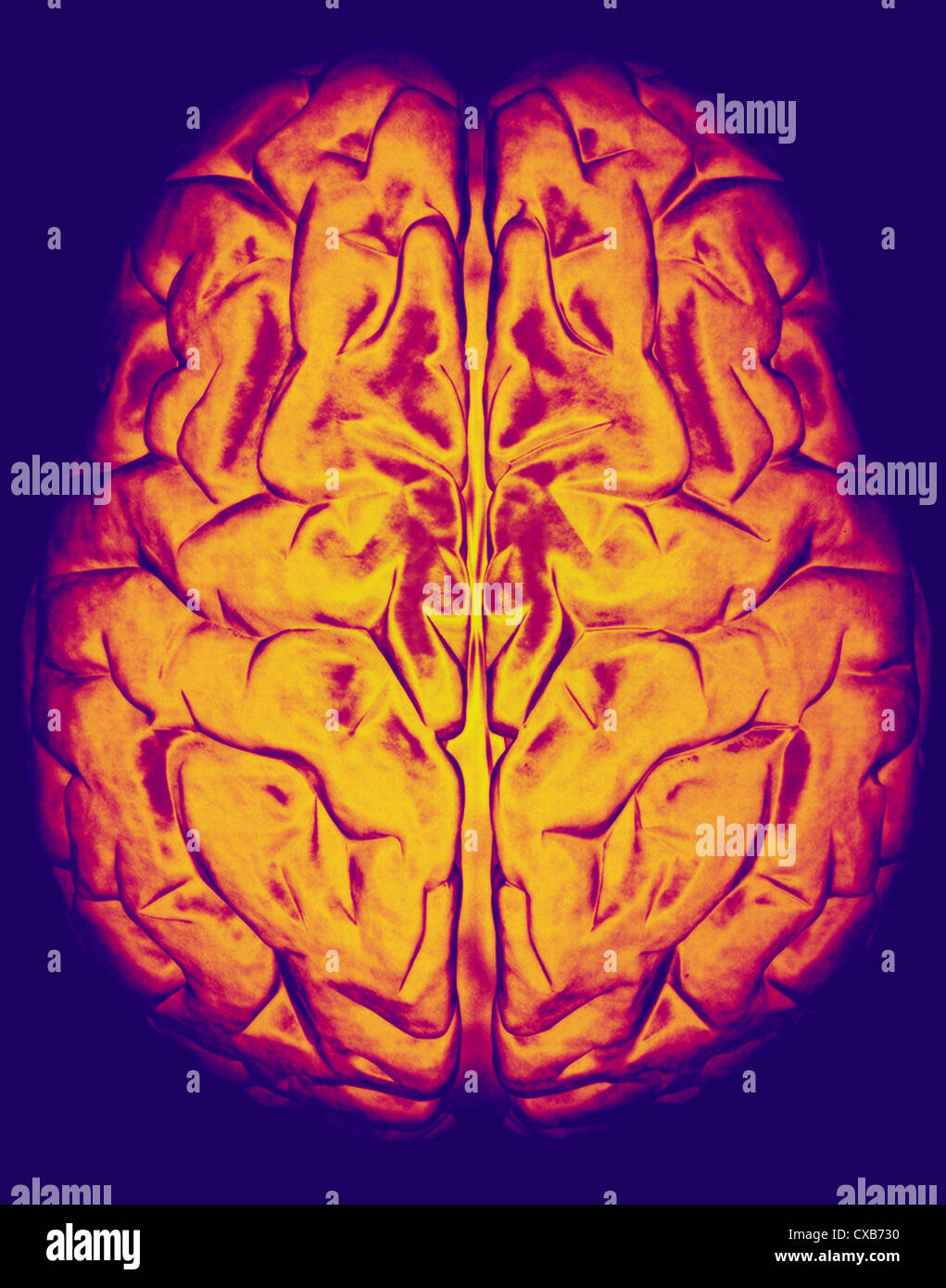 computer generated model human brain Stock Photo