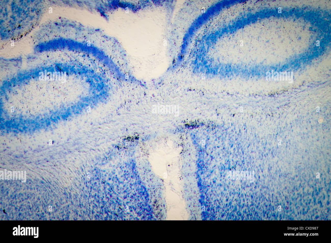microscopy rat brain hippocampal neurons Stock Photo
