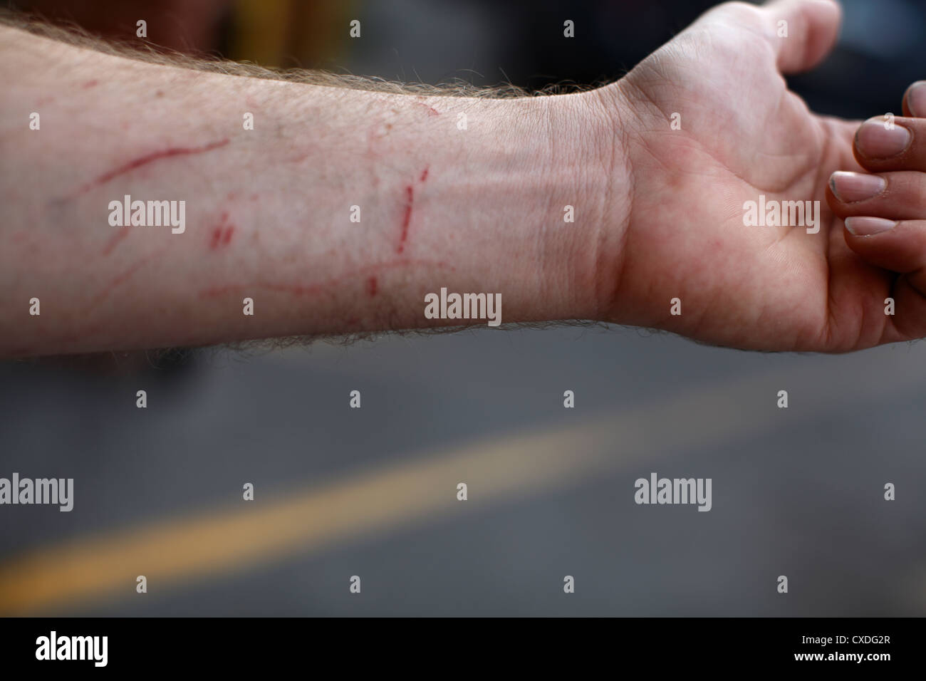 Male forearm with scratches Stock Photo Alamy