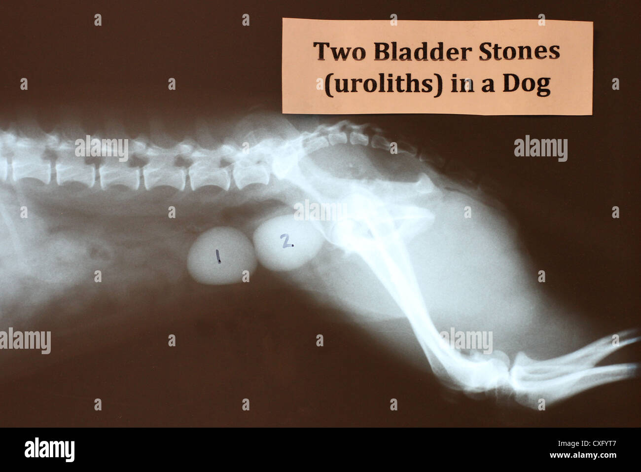 Bladder Stones High Resolution Stock Photography and Images - Alamy