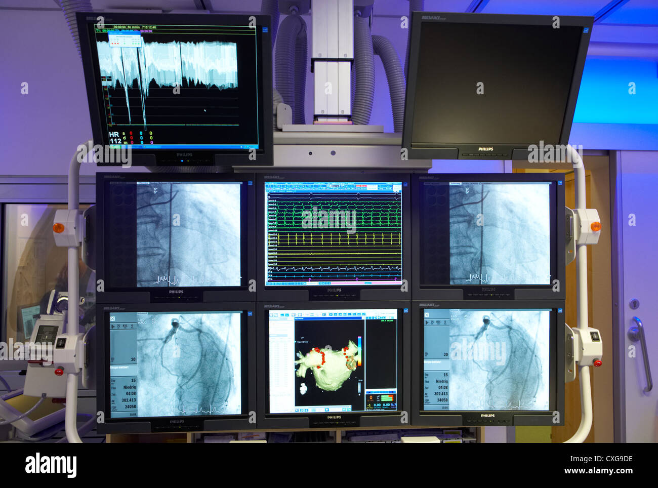Berlin, monitors in a highly modern cardiology clinic Stock Photo - Alamy