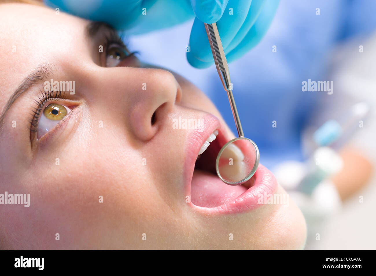 Dental mirror inside patient open mouth teeth reflection medical