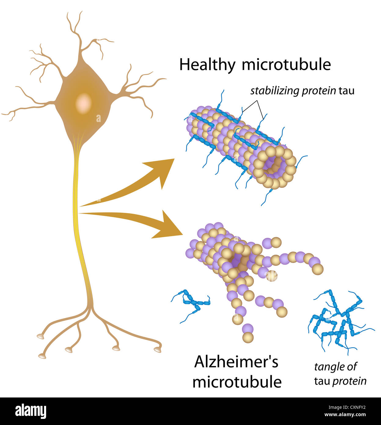 Neurofibrillary tangle hires stock photography and images Alamy