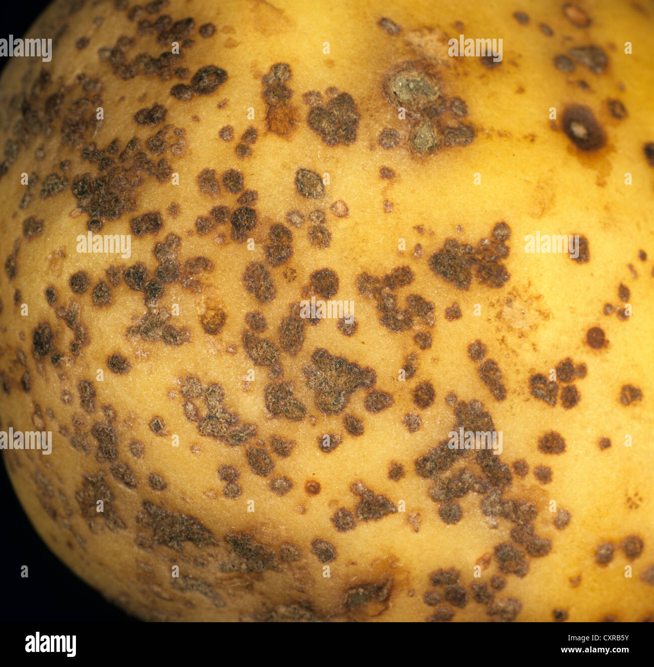 Powdery scab, Spongospora subterranea, lesions on a potato tuber Stock Photo