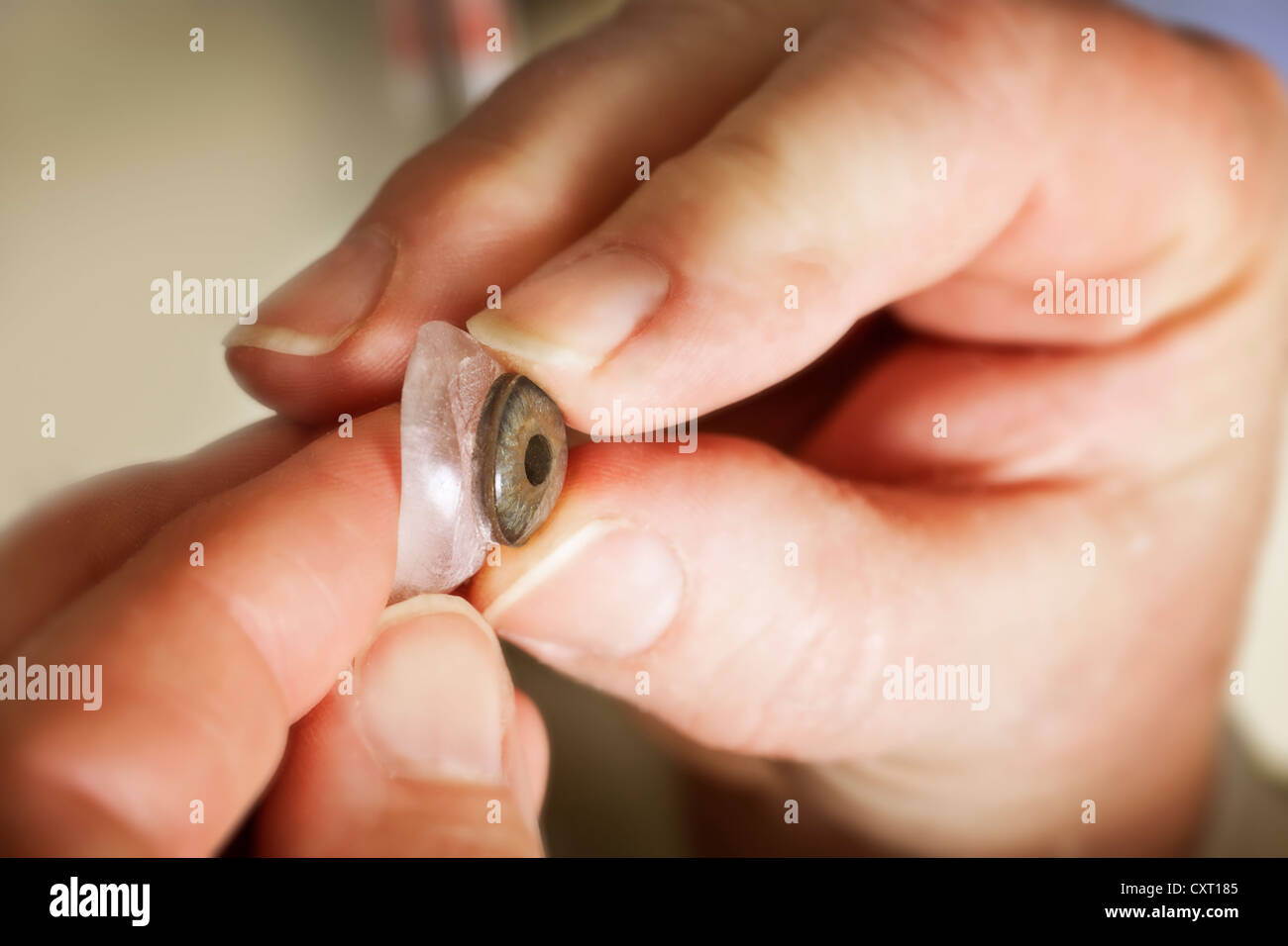 Production of an artificial eye, ocular prosthesis, insertion of the