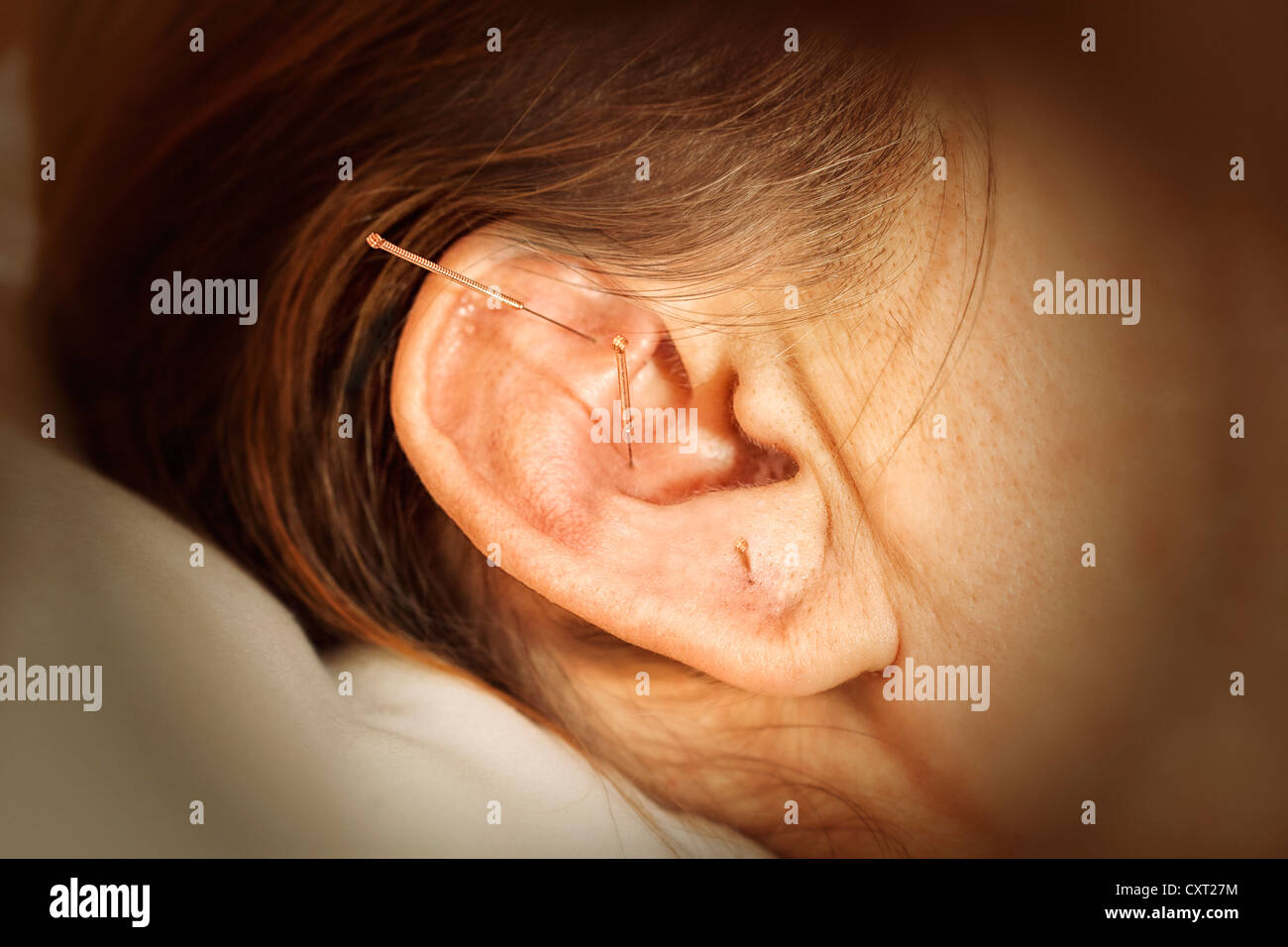 Ear, acupuncture treatment, Traditional Chinese Medicine Stock Photo Alamy