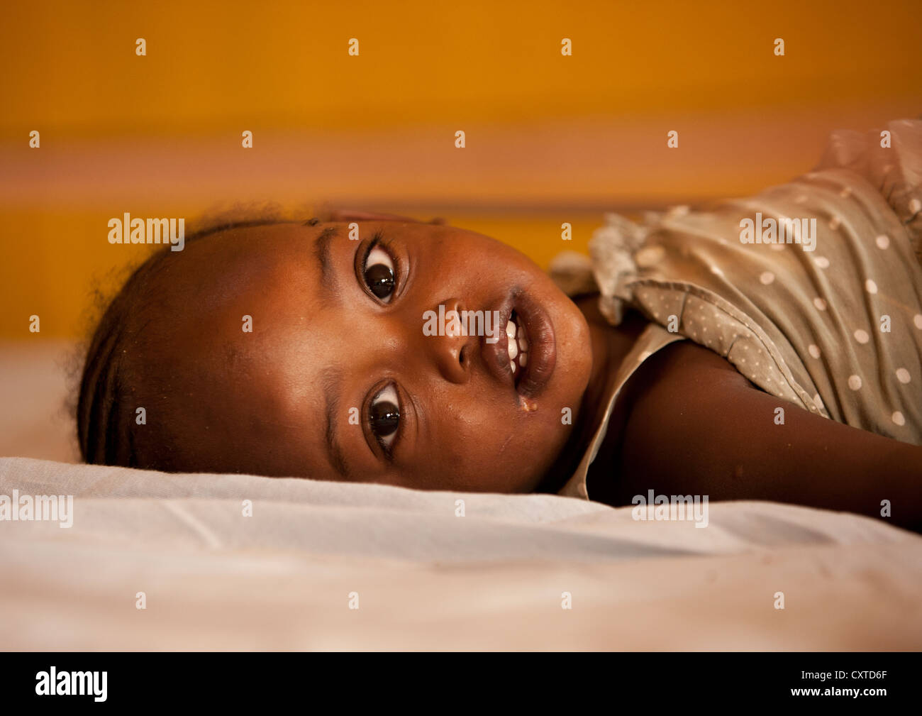 Mingi Baby Rescued In Omochild Foundation, Jinka, Omo Valley, Ethiopia