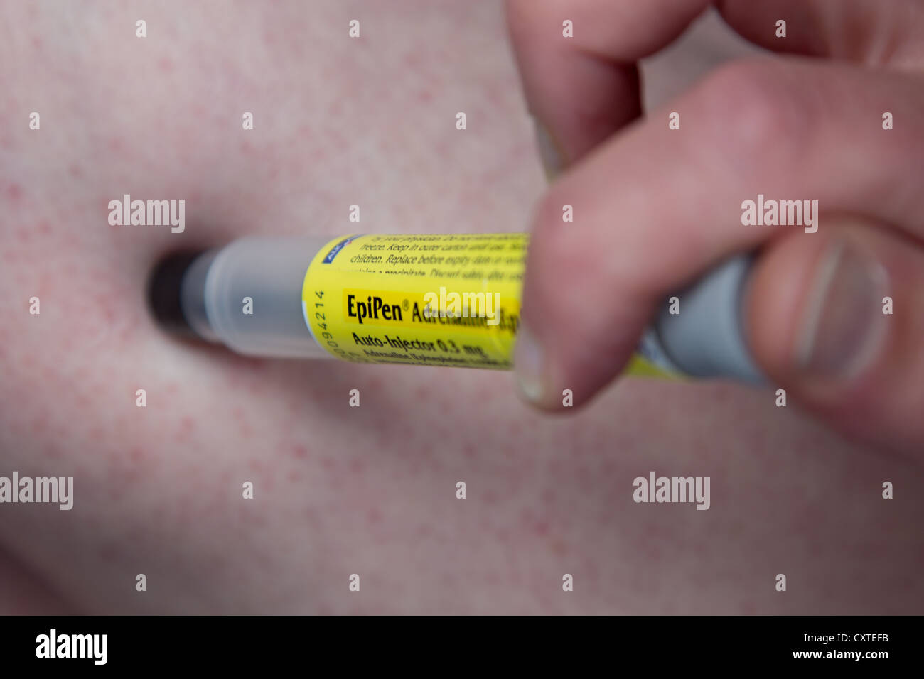 An acute allergy sufferer preparing to inject adrenaline into his leg using an EpiPen injector Stock Photo