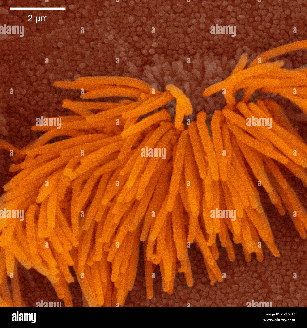 Scanning electron micrograph of lung trachea Stock Photo Alamy