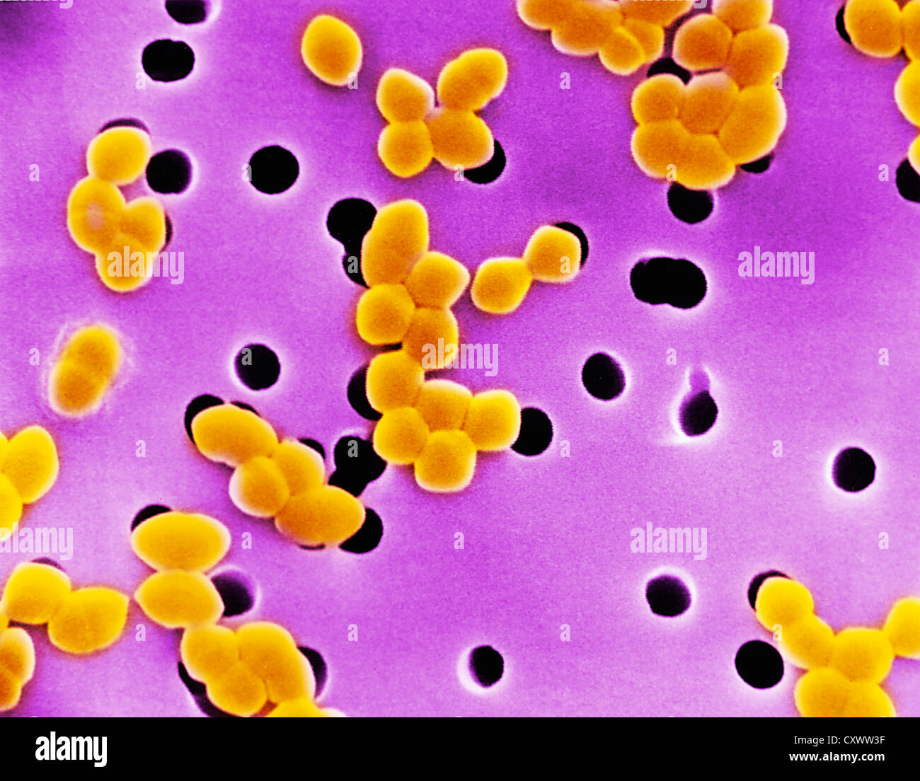 Enterococcus Faecalis Gram Stain Morphology