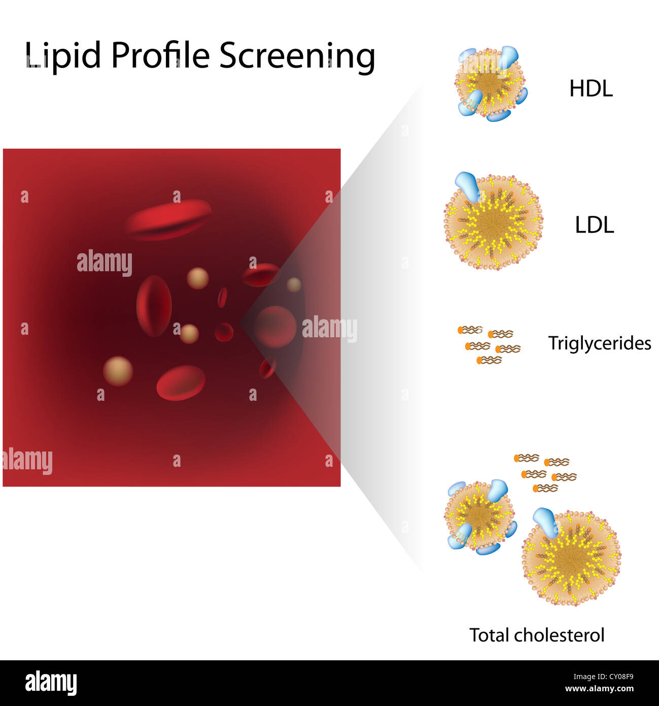 Lipid profile blood test Stock Photo