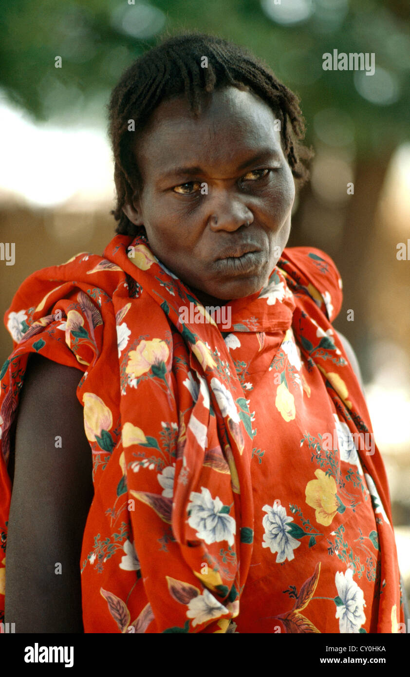 El Geneina Sudan Woman With Leprosy Stock Photo