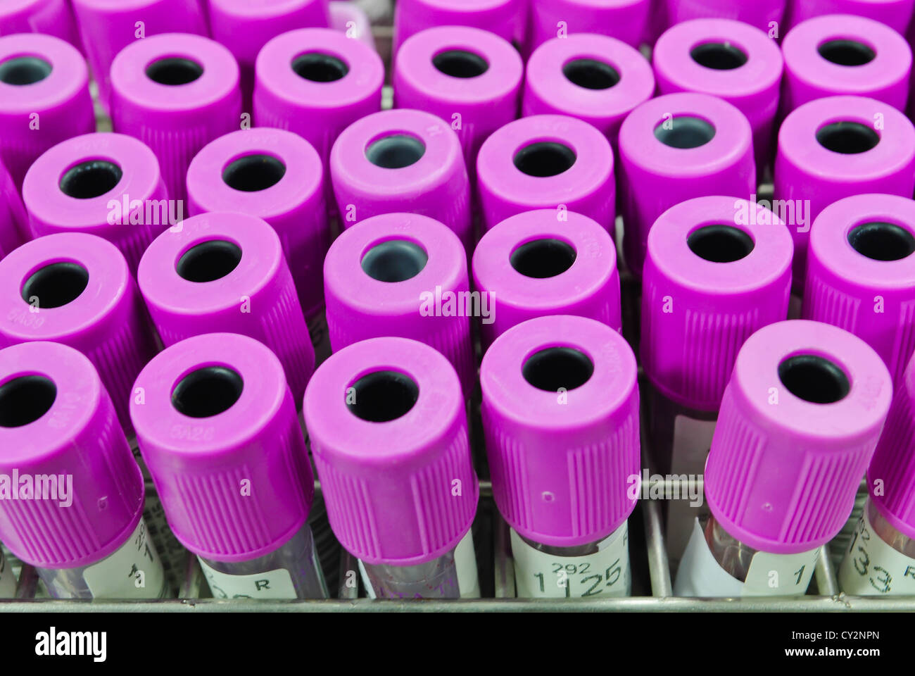 a view blood tubes in detail Stock Photo Alamy