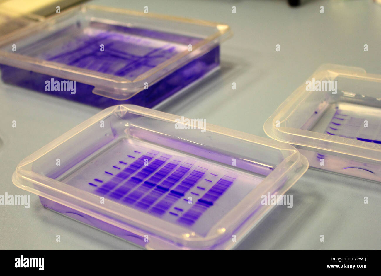 Coomassie blue stained protein gels Stock Photo Alamy