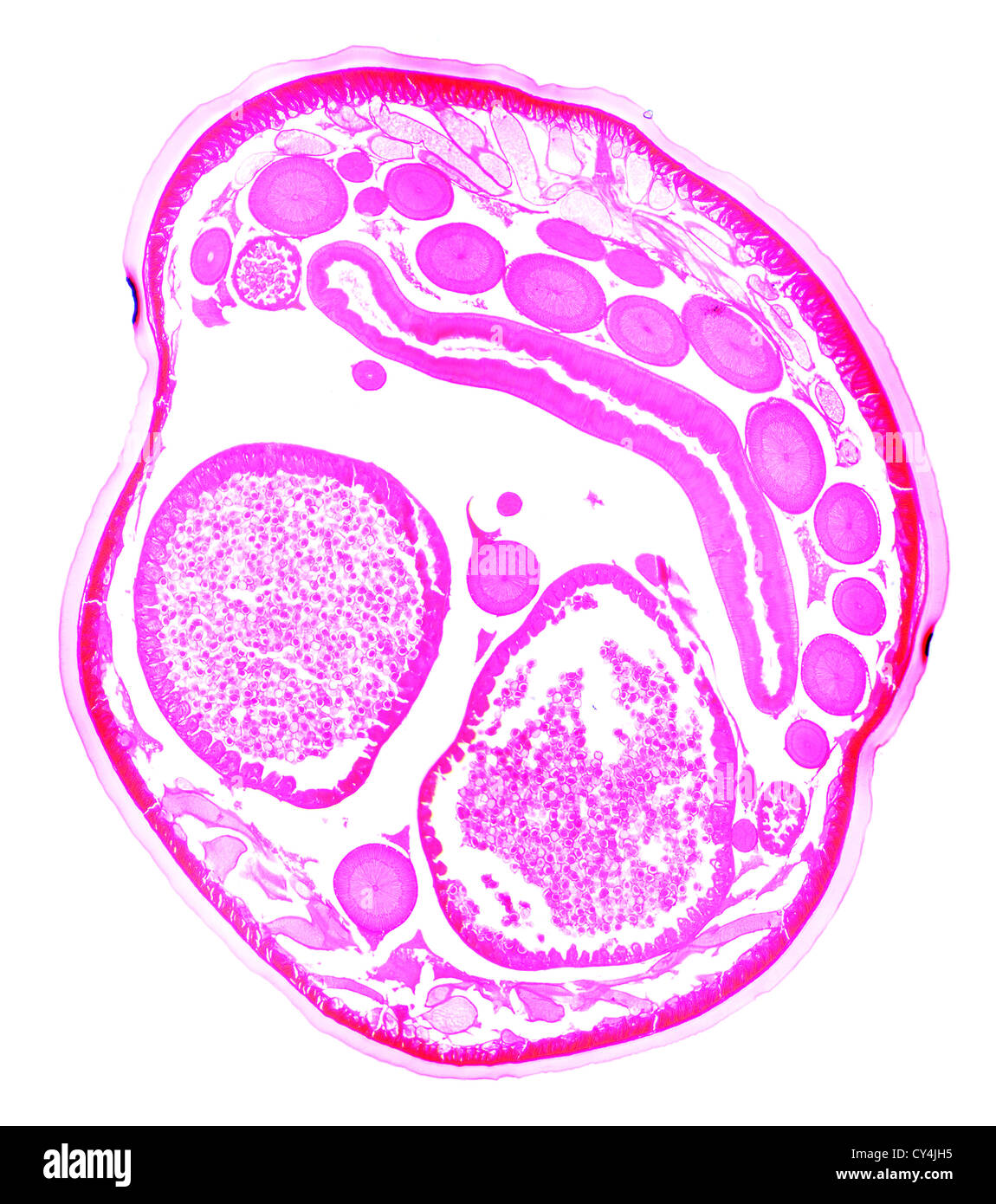 Ascaris under the microscope, background Stock Photo