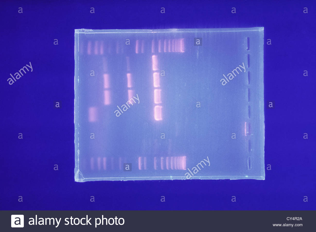 Gel Electrophoresis Stock Photos & Gel Electrophoresis Stock Images Alamy
