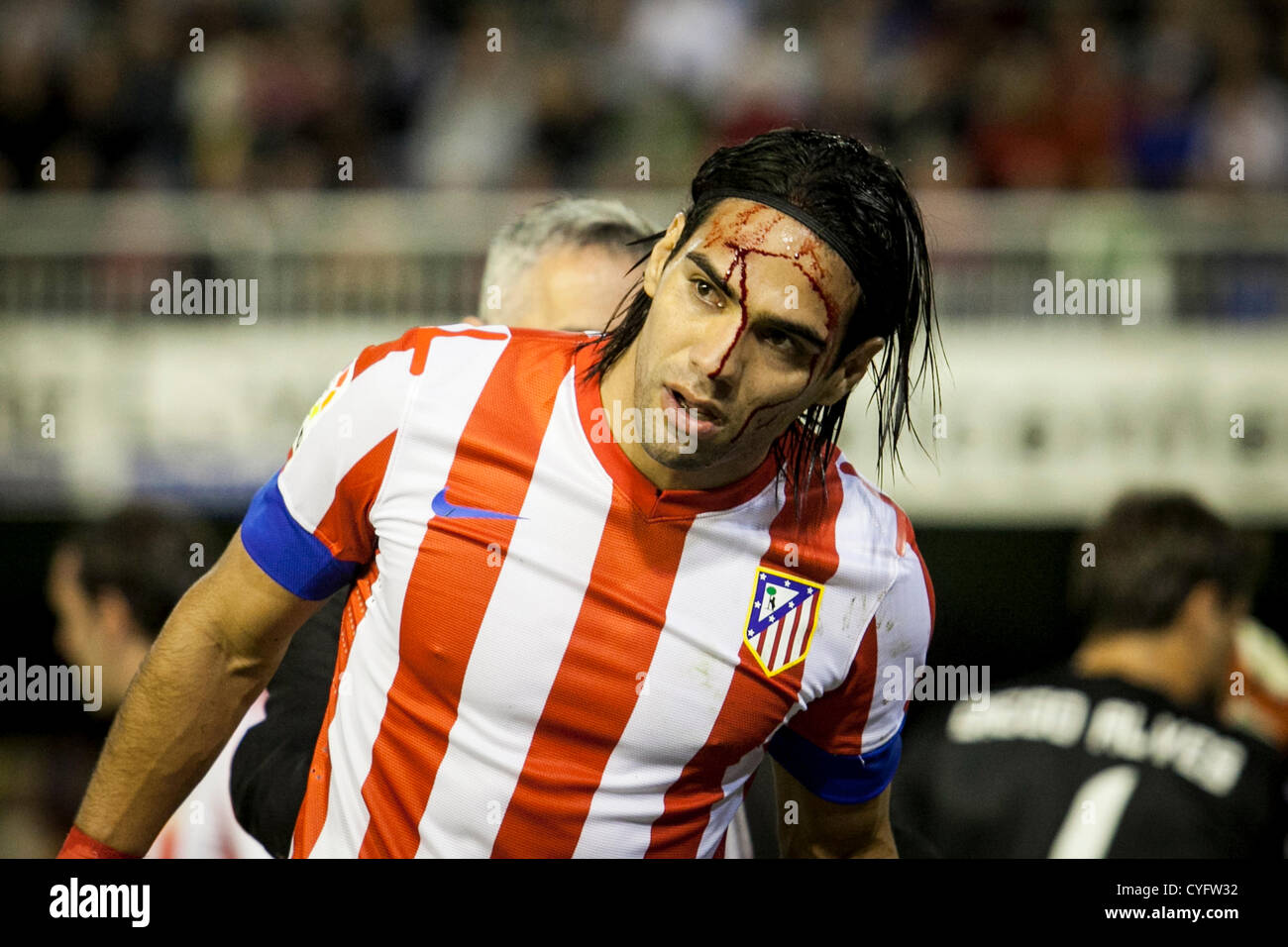 03.11.2012 Valencia, Spain. Forward Radamel Falcao of Athletico Madrid bleeds after an encounter with Forward Roberto Soldado of Valencia CF during the La Liga game between Valencia and Athletico Madrid from the Mestalla Stadium. Stock Photo