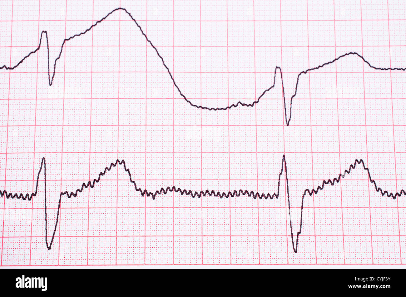 EKG diagramm on paper Stock Photo
