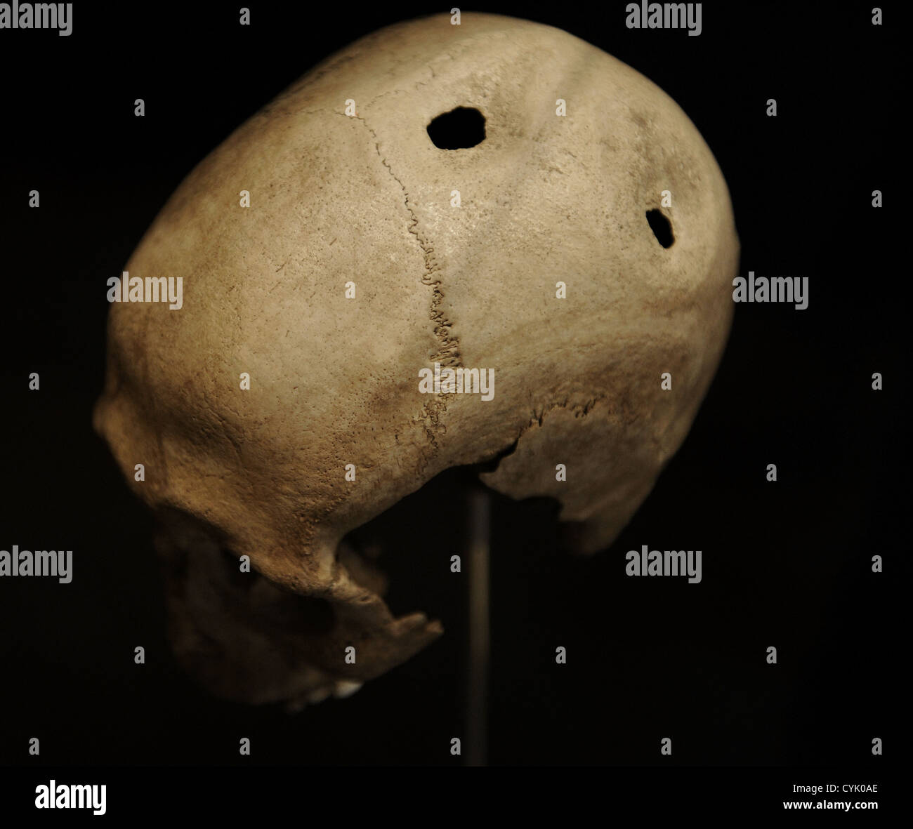 Trepanned skull of a man. 21-35 years old. 3500-3400 BC. From Dojringe Mose, Zealand. National Museum of Denmark. Stock Photo