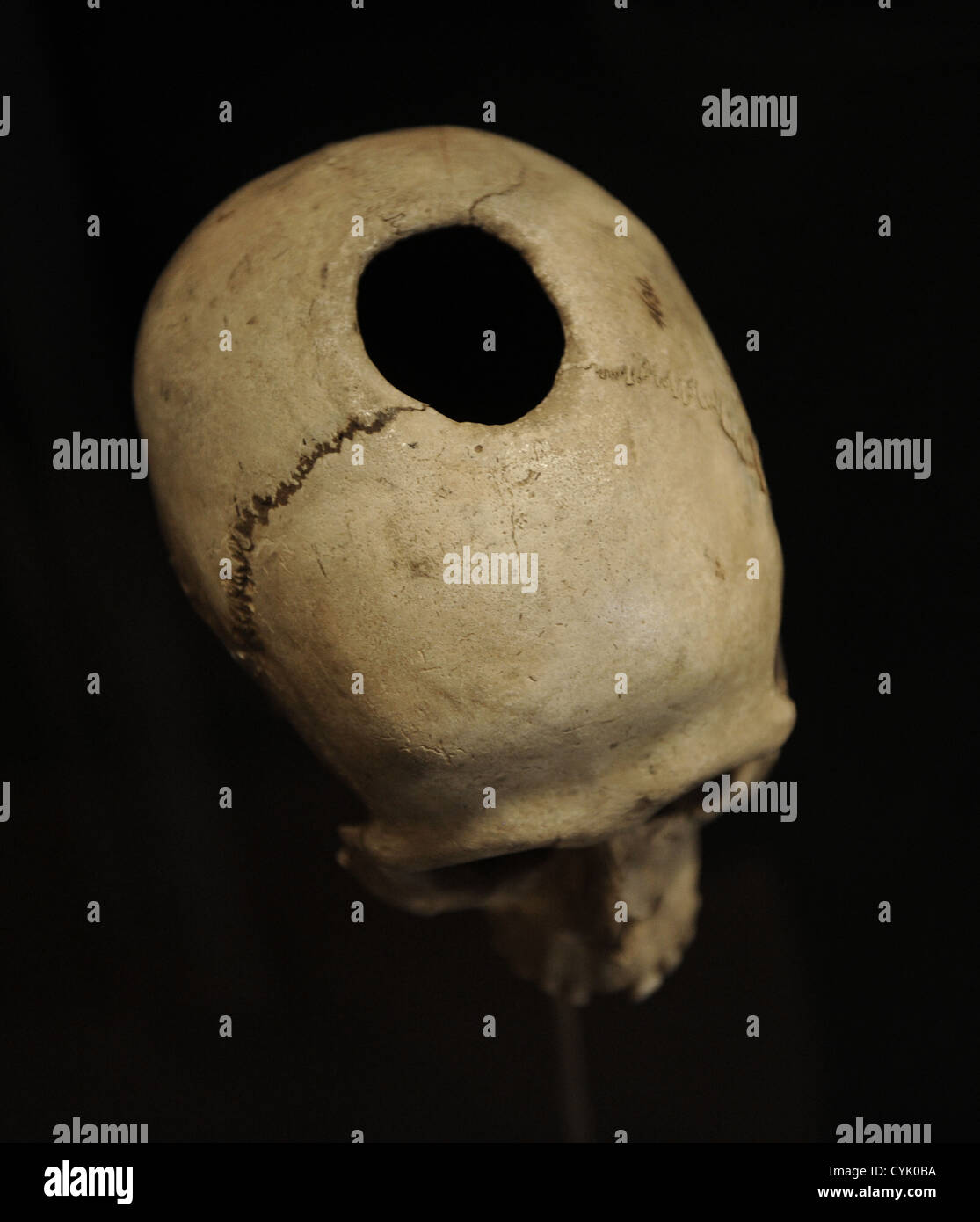 Trepanned skull. From a grave in Naes, Falster. Neolithic. National Museum of Denmark. Copenhagen. Denmark. Stock Photo