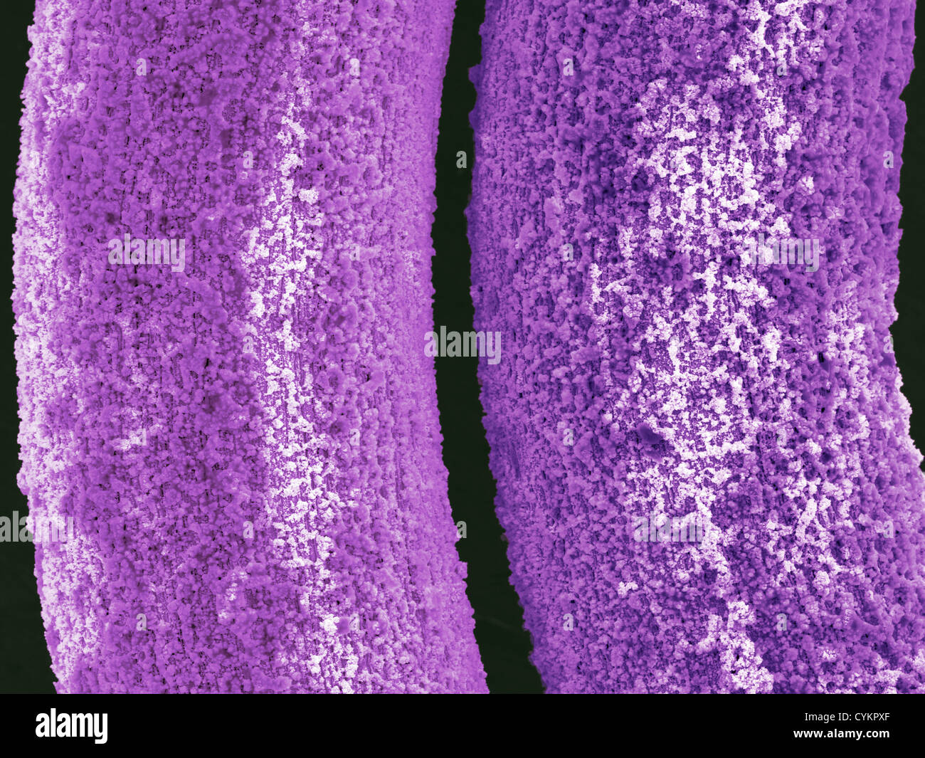 SEM of chemically deposited Antimony on metallic substrate (closer view) Stock Photo
