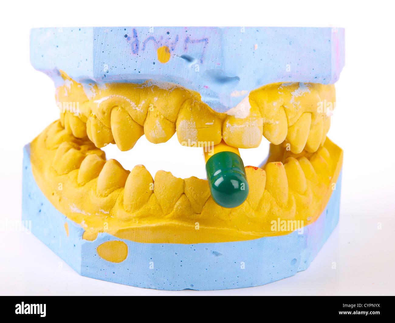teeth plaster cast Stock Photo Alamy