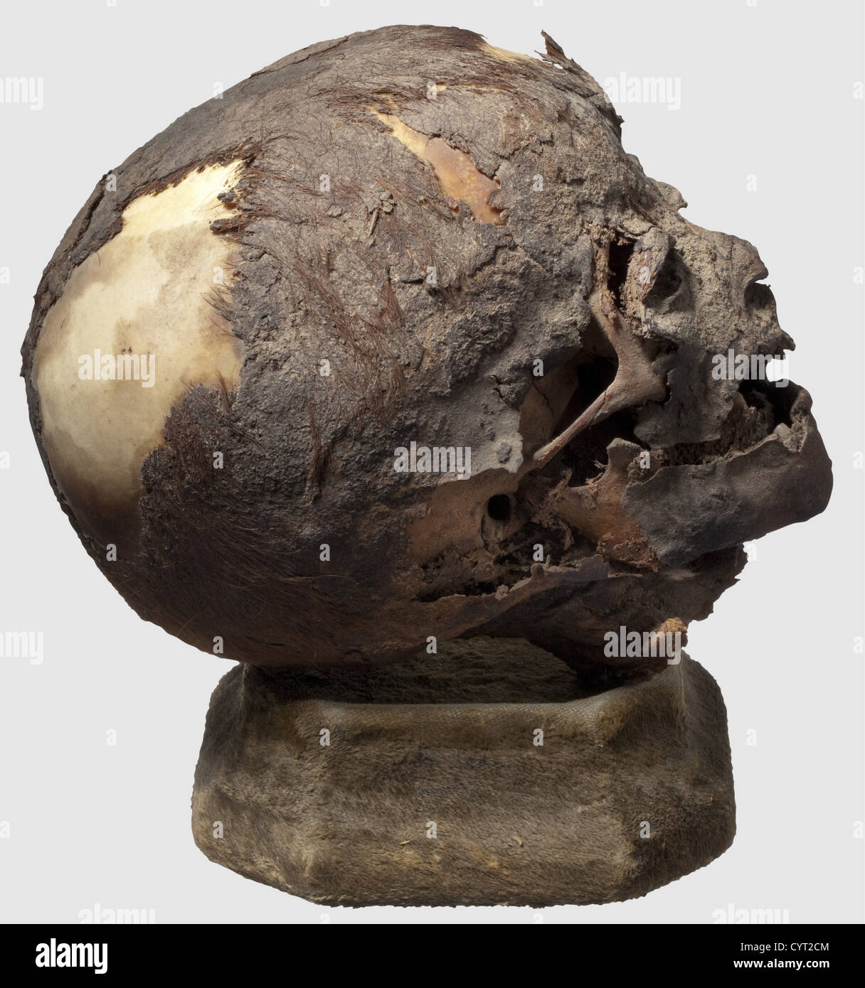 A skull of an Egyptian mummy of a child,third Intermediate Period,ca.1000 BC The prepared head of a child retaining reddish-brown hair in places.At the back of the skull,there are still pieces of the bandages with which the mummy was wrapped.Height of the skull ca.16 cm.Under glass in an ebonized showcase which opens by a sliding panel.One glass pane missing.Dimensions 28 x 21 x 36 cm.After Napoleon's Egyptian campaign,modern Egyptian archeology began in 1822 with Jean Francois Champollion and Karl Richard Lepsius.The discoveries made by these men l,Additional-Rights-Clearences-Not Available Stock Photo