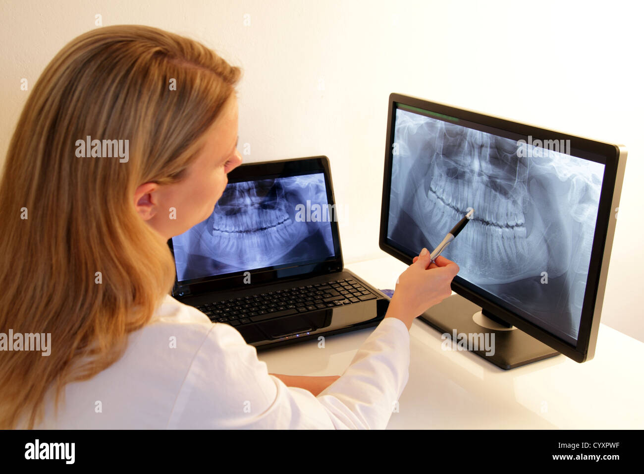 Dentis explaining a a-ray on a Monitor Stock Photo - Alamy