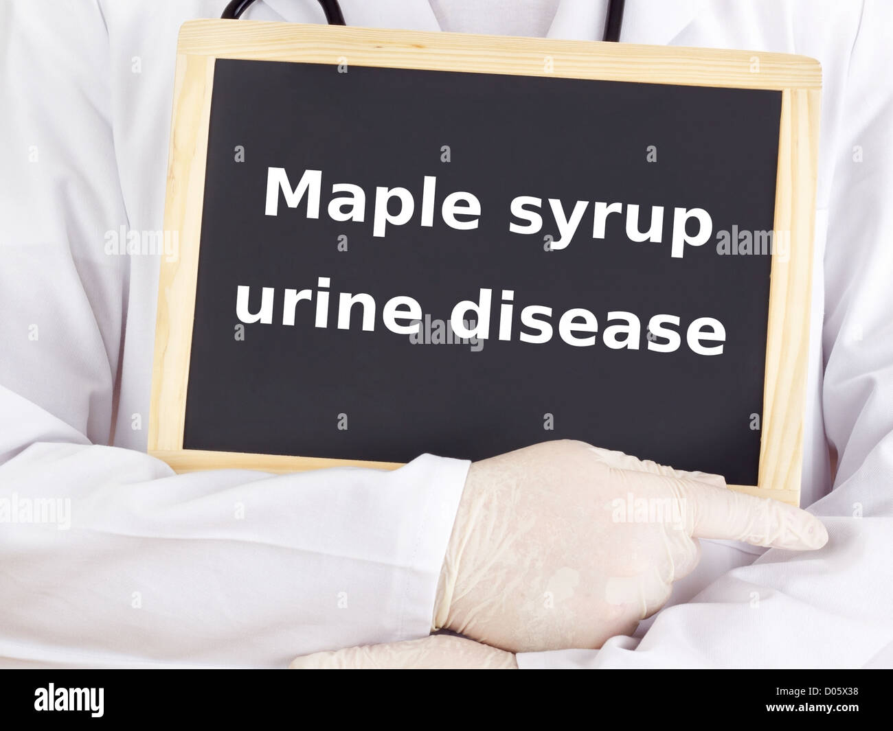 Doctor shows information on blackboard maple syrup urine disease Stock
