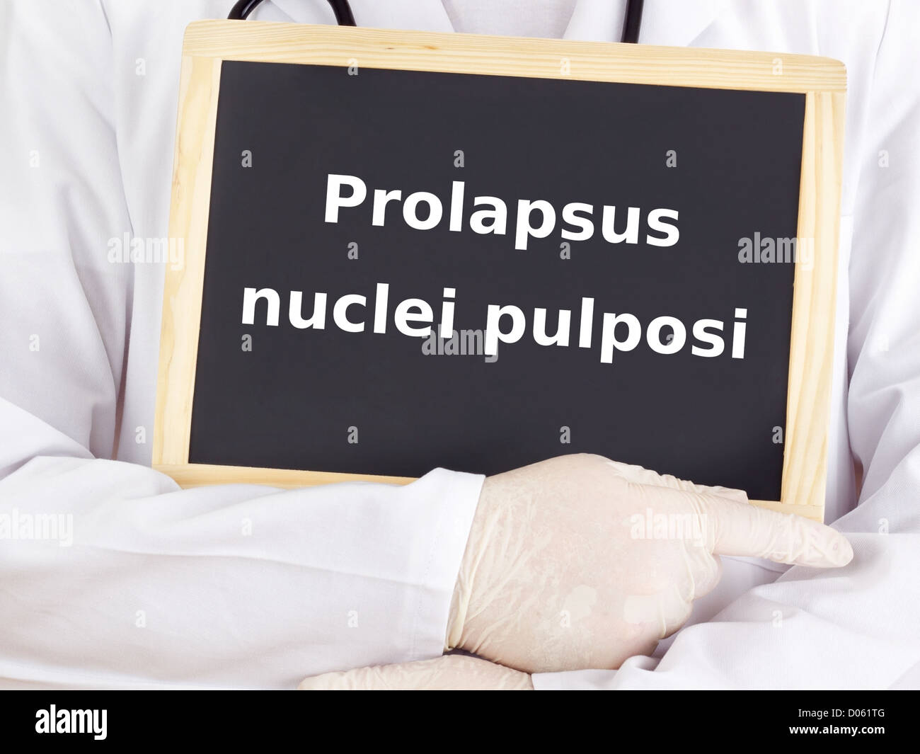 Doctor shows information: prolapsus disci intervertebralis Stock Photo
