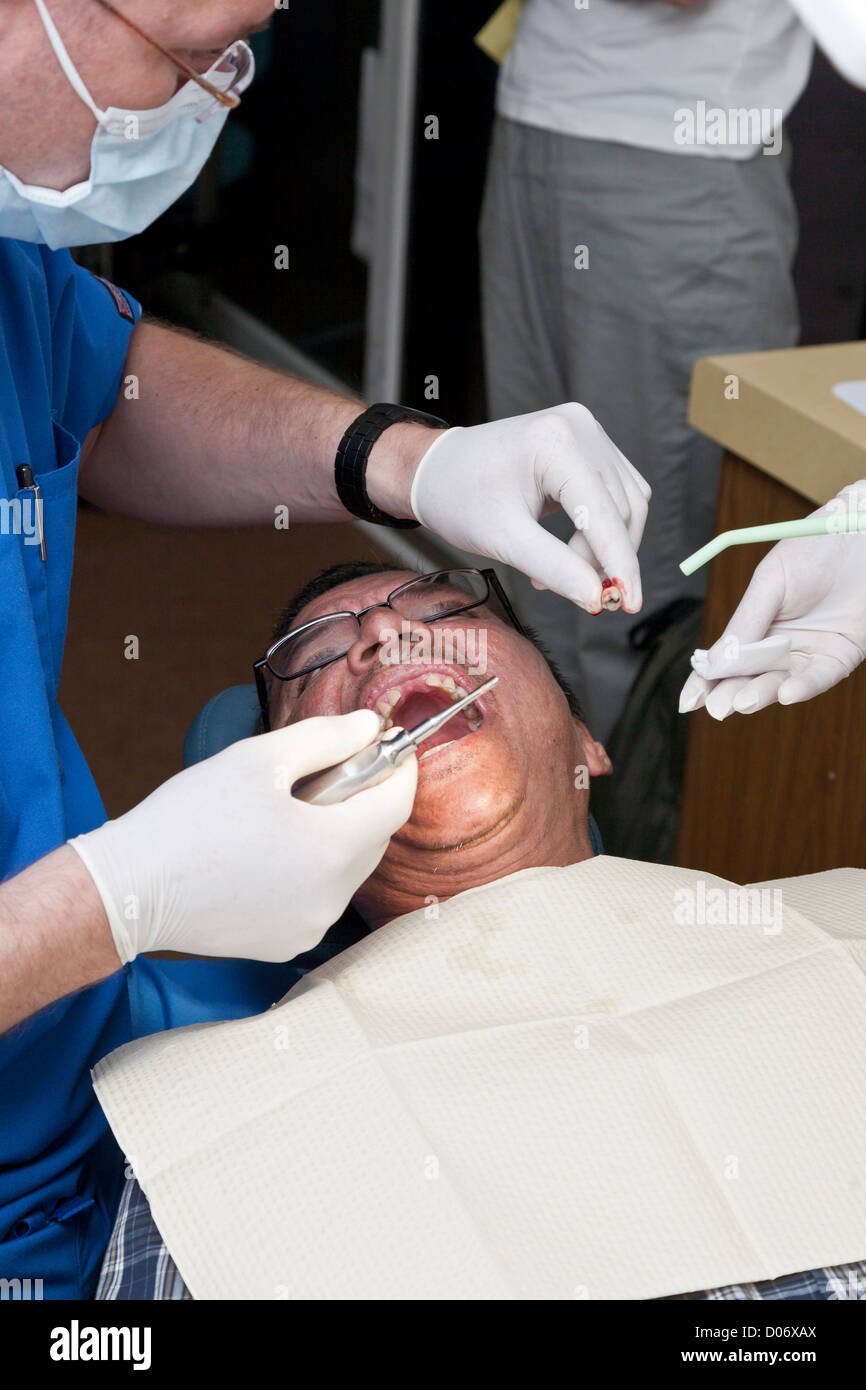 Male volunteer dentist extracts tooth while providing dental services
