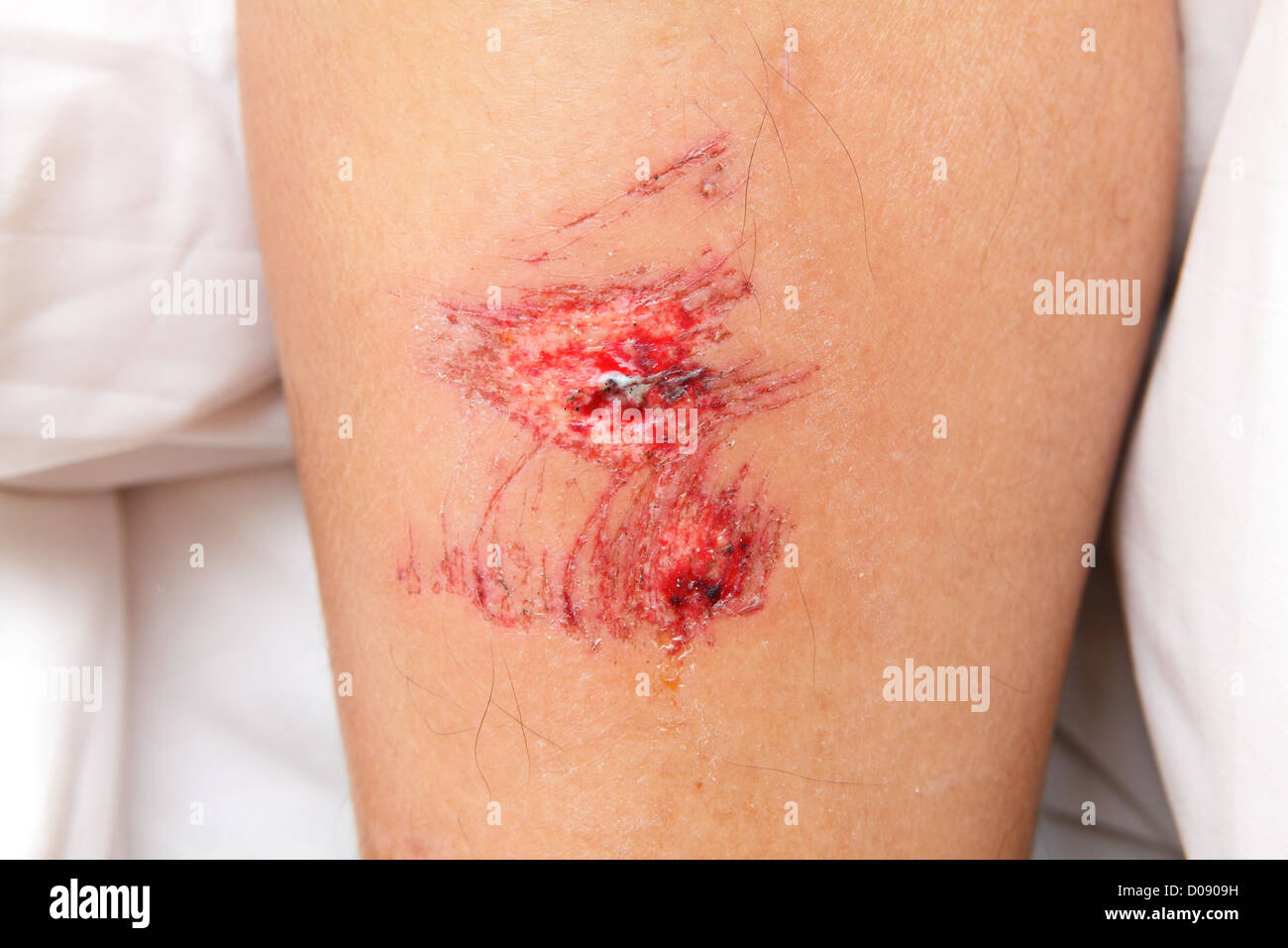 wound Stock Photo
