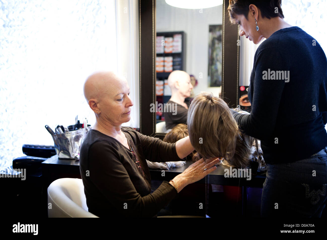 ALOPECIA, WOMAN Stock Photo