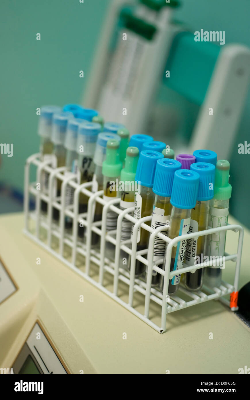 Prothrombin time test tubes diagonal Stock Photo Alamy