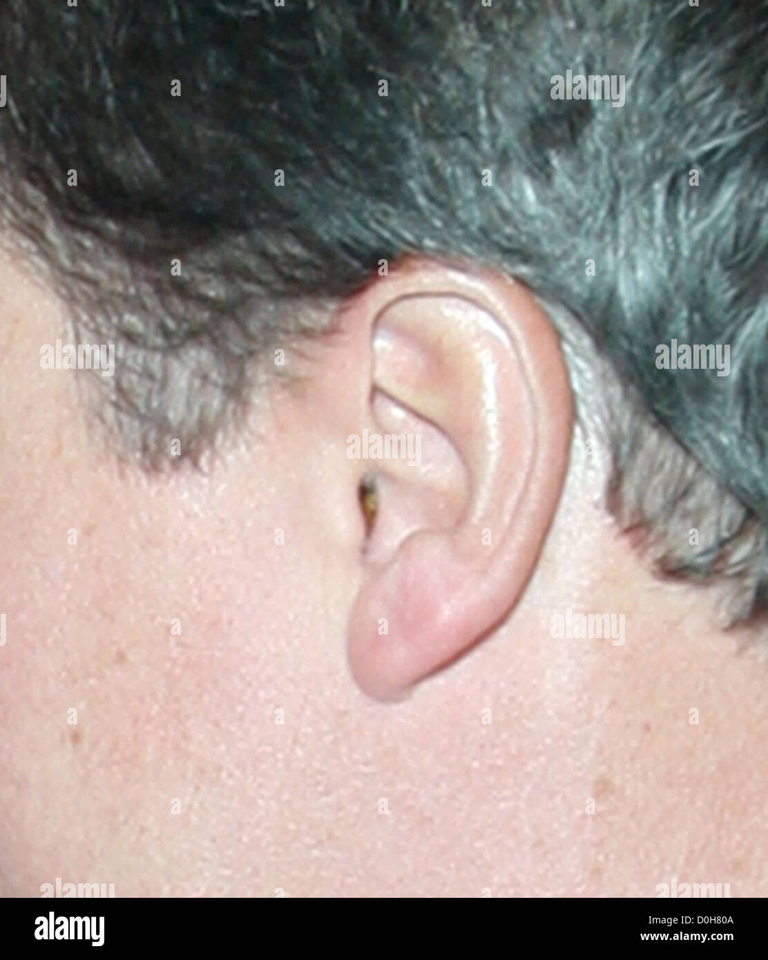 Paparazzi ear wax ear hi-res stock photography and images - Alamy