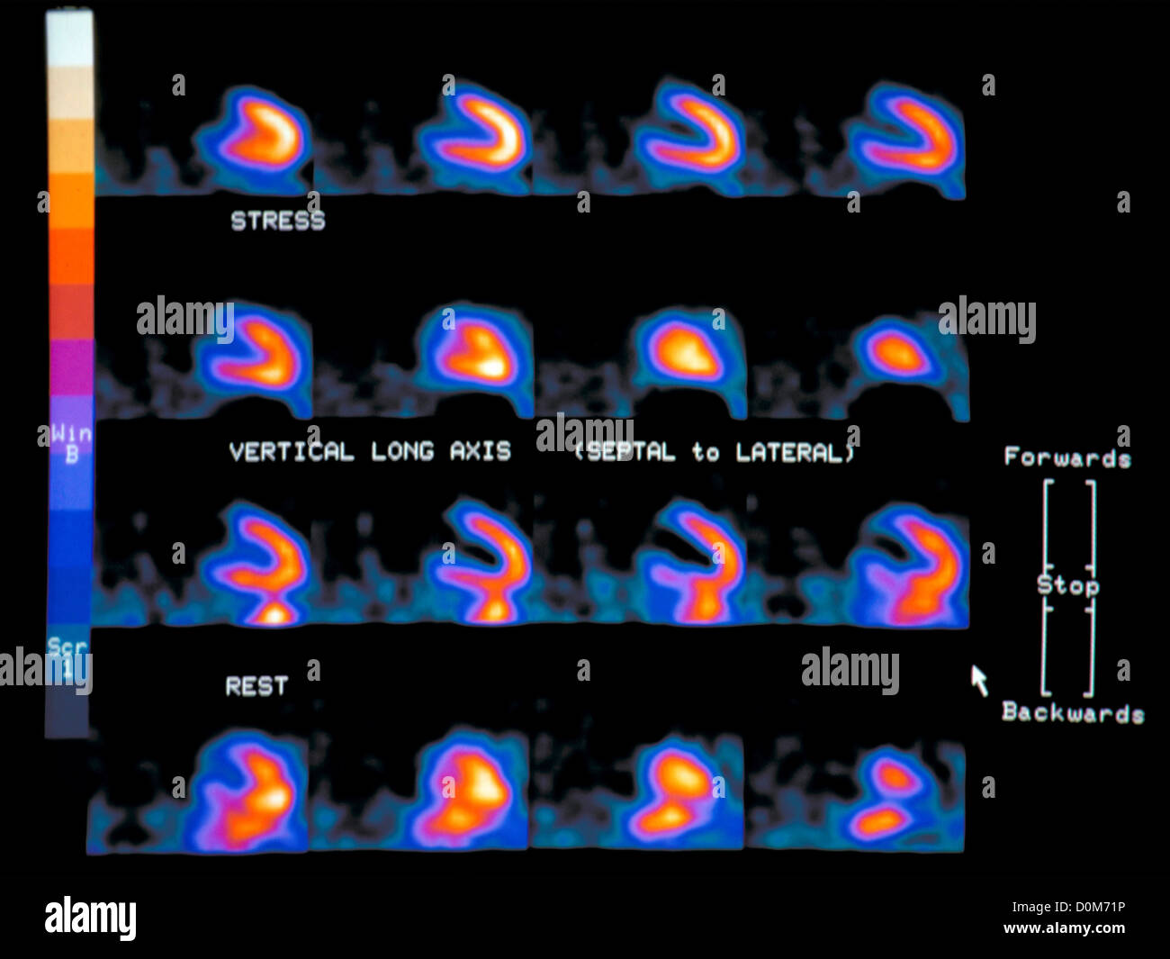 Myocardial perfusion imaging apartmentlasopa