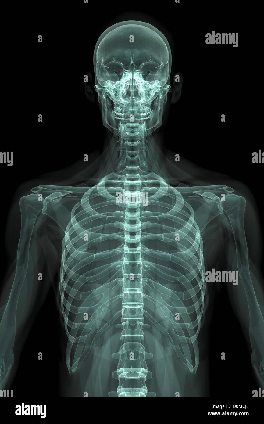 X Ray Image Showing The Rib Cage Stock Photo Alamy