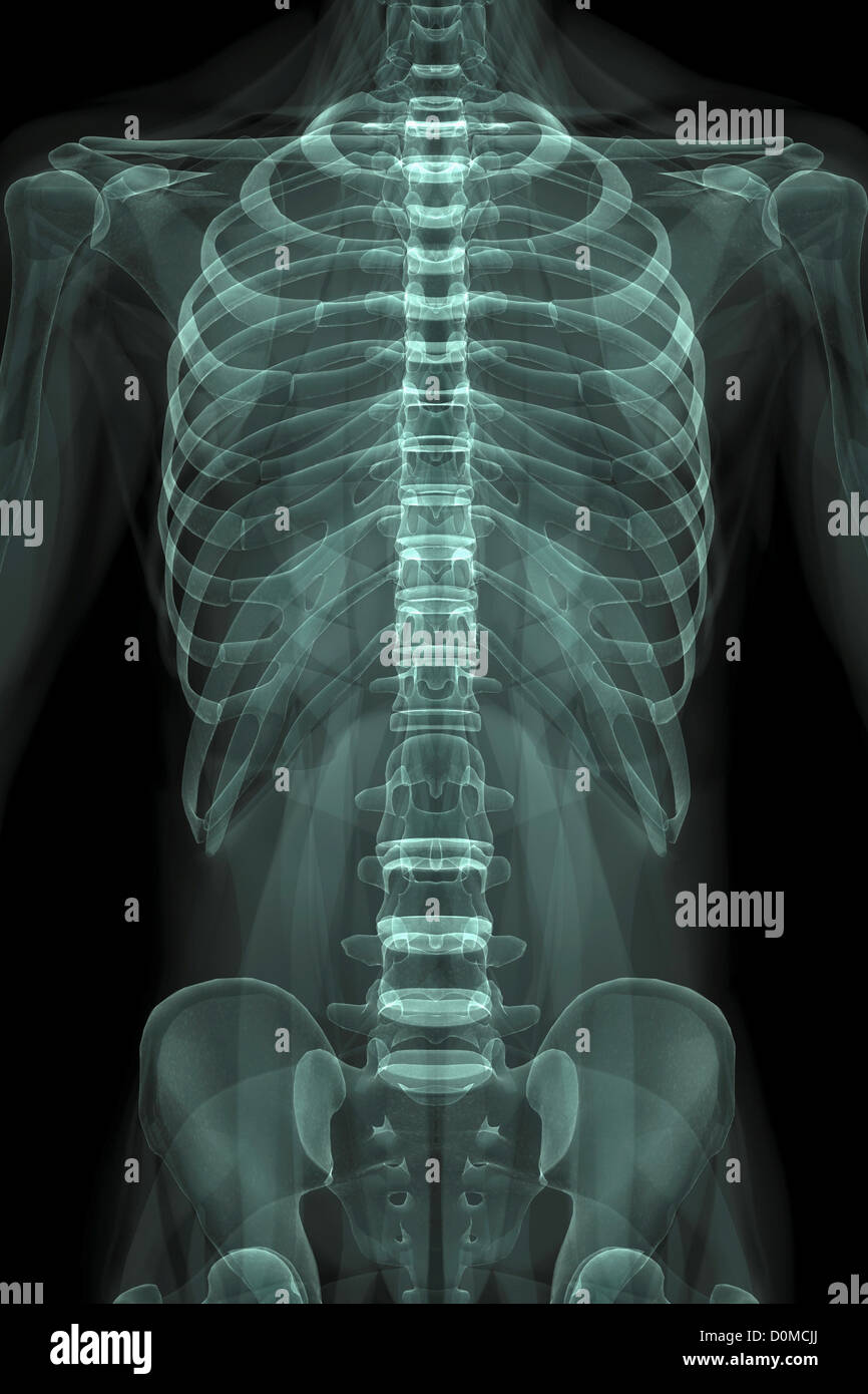 XRay image showing the rib cage and pelvis Stock Photo Alamy