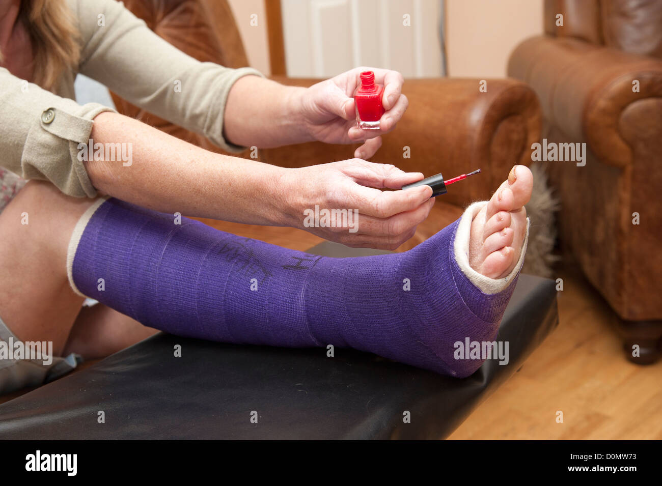 Woman with broken ankle painting her toe nails with red nail polish Stock Photo